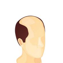 hair loss cure
